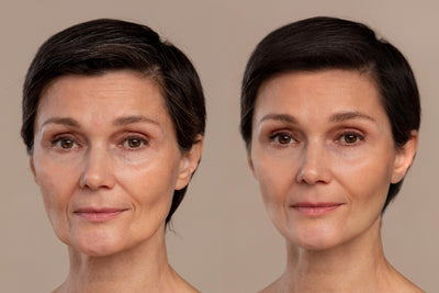 Before & After: How Menoveda Helped My Skin in Menopause (Real Story)